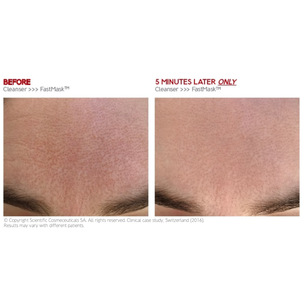 Dr. Levy 3Deep Cleanser > FastMask