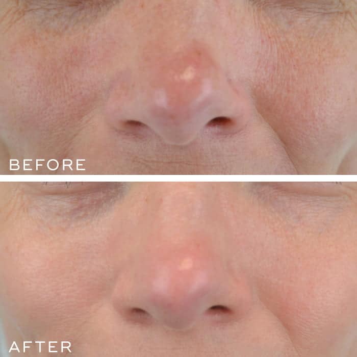 Medik8 Crystal Retinal 10