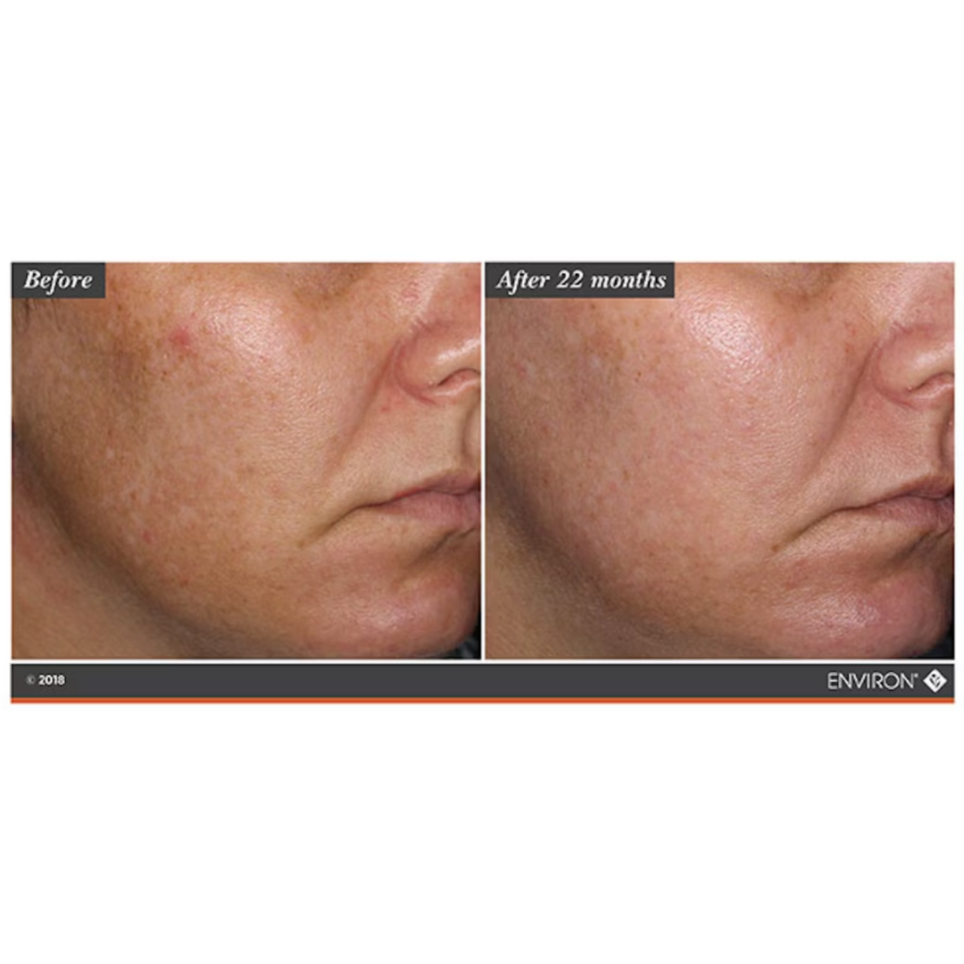 Environ C-Boost Mela Even Cream Twin Set