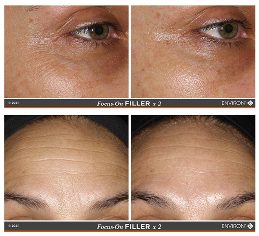 Environ 3D Filler Crème, Frown Serum & Focus-CIT | Products vs Procedures Edit