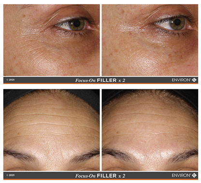 Environ 3D Filler Crème, Frown Serum & Focus-CIT | Products vs Procedures Edit