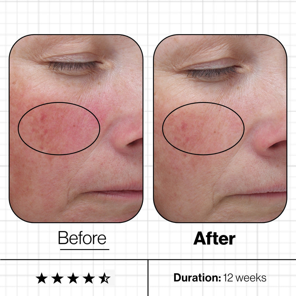 Advanced Nutrition Programme Skin Even IQ | 3 Month Challenge