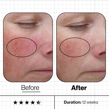 Advanced Nutrition Programme Skin Even IQ | 3 Month Challenge