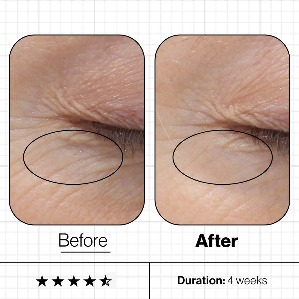 Advanced Nutrition Programme Skin Youth Biome | 3 Month Challenge