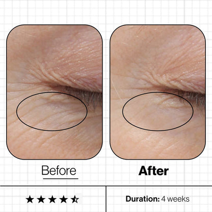 Advanced Nutrition Programme Skin Youth Biome | 3 Month Challenge