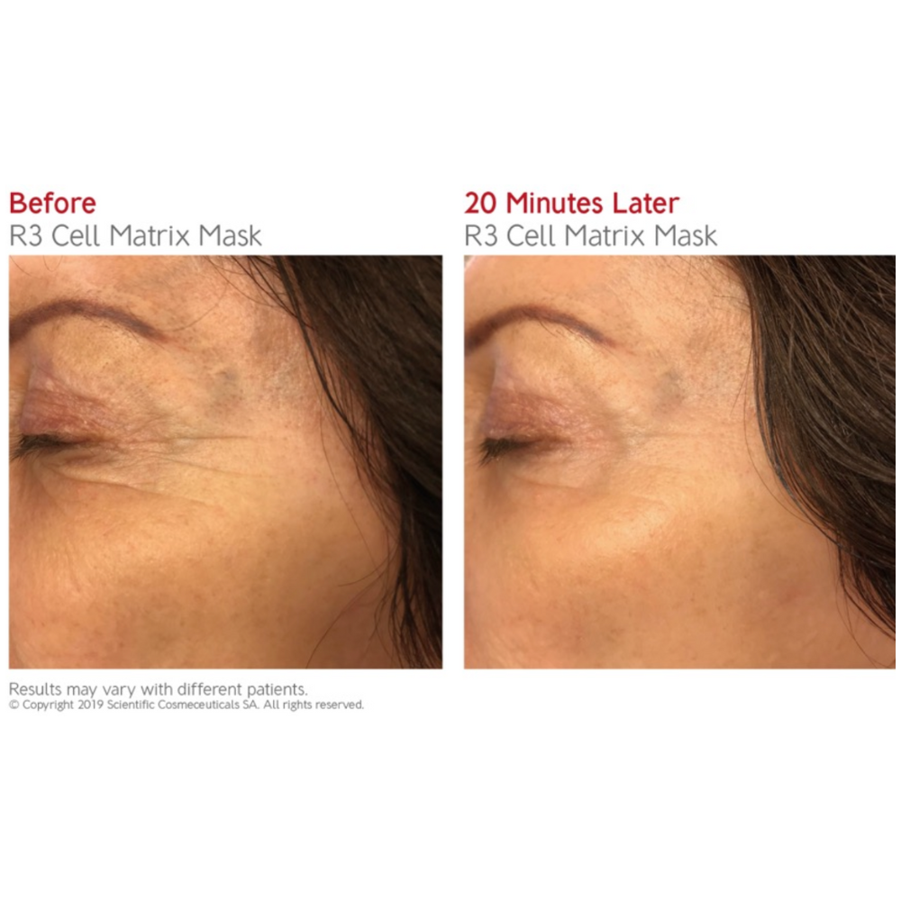 Dr. LEVY Swiss Stem Cell Discovery Set | Exclusive Chelleon Soft Launch Bundle