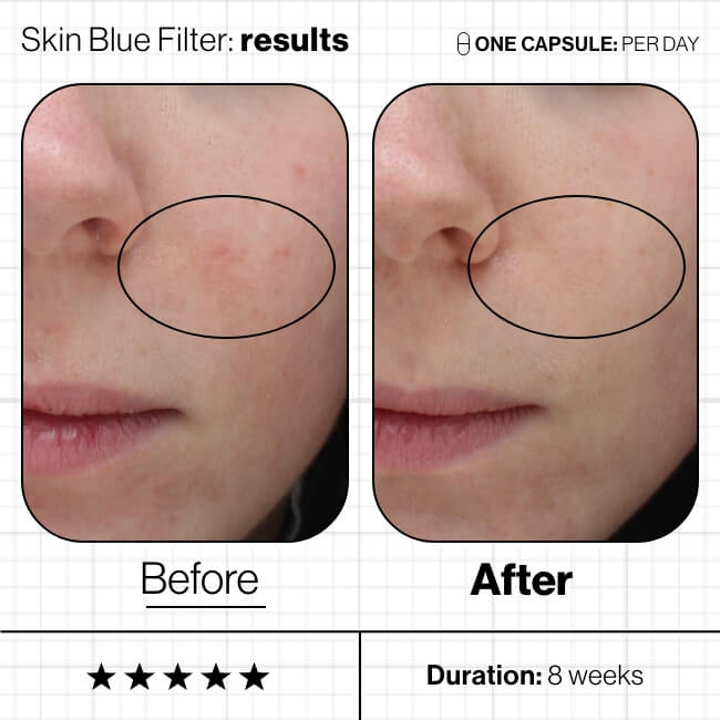 skin blue filter before and after image
